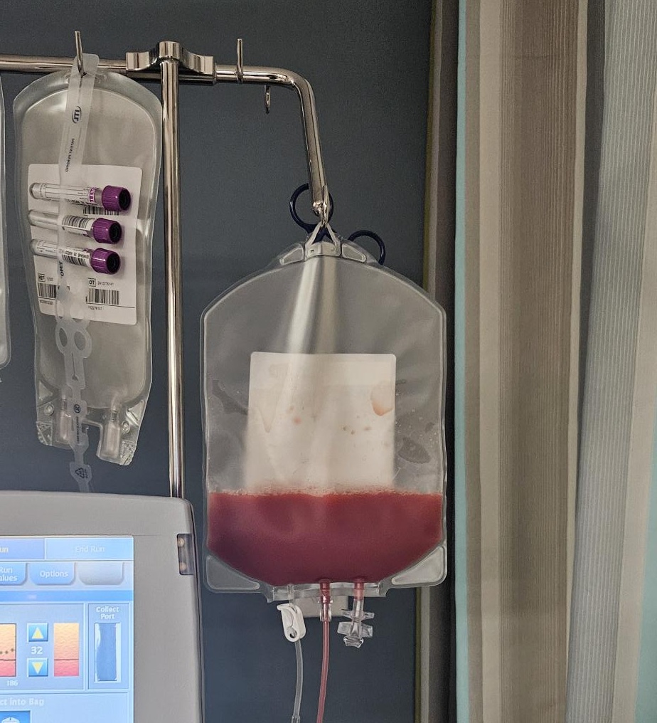 Fresh leukopak blood product in lab packaging