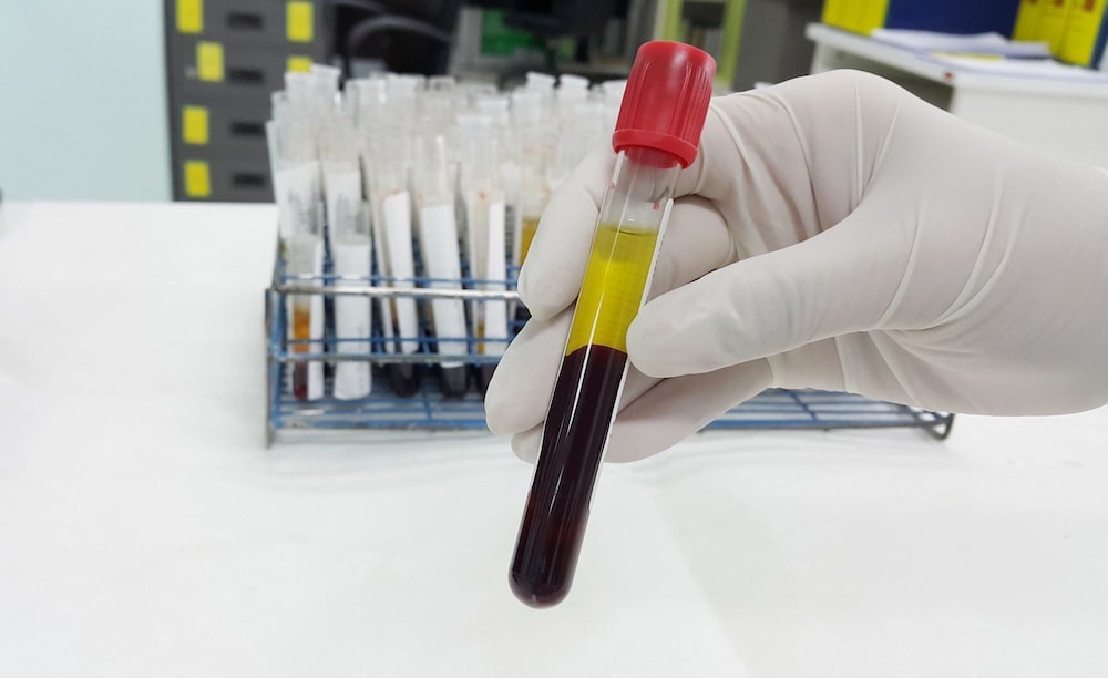 Human blood sample collection for oncology research